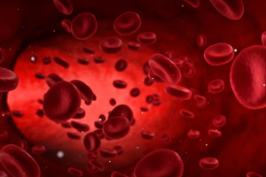 خونریزی از واژن